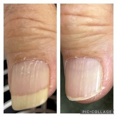 あなたの爪を整えます。自爪ケア