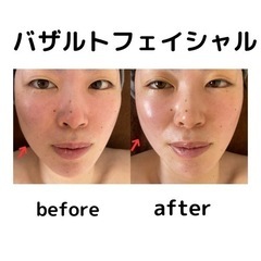 バザルトフェイシャル　つやつや　もちぷる