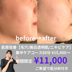 【4種の肌質改善コース】