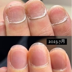チビ爪さんのためのネイル自爪育成 - 美容