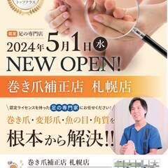 【巻き爪補正店札幌店】巻き爪・タコ・魚の目・かかと角質のモニター募集の画像