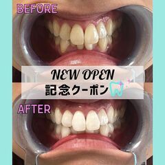 《体験クーポン1,680円～》駅近☆柏市南柏にセルフホワイトニング専門店がOPEN！自分史上最高の白い歯に★ - 美容