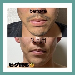 【光＆WAX脱毛】セラヴィプライベートサロン（メンズ・キッズも可）の画像
