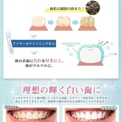 【日本企業出品】 ホワイトニングペン 歯 ホワイトニングジェル 美歯 パック ホーム 歯を白くする マウスピース ジェル 歯の黄ばみを落とし 2本入りの画像