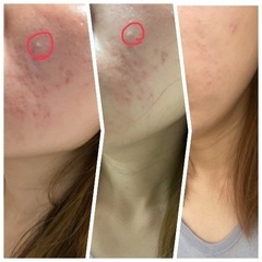 シミ、シワ、毛穴、敏感肌、アトピー肌のお悩み解消を得意とする肌ケア専門サロン - 京田辺市