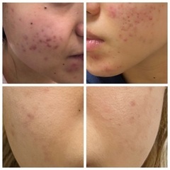 シミ、シワ、毛穴、敏感肌、アトピー肌のお悩み解消を得意とする肌ケア専門サロン - 美容