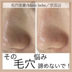 シミ、シワ、毛穴、敏感肌、アトピー肌のお悩み解消を得意とする肌ケア専門サロン − 京都府
