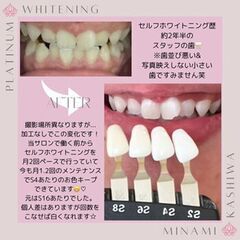 セルフホワイトニング歴約2年半のスタッフの歯の変化★口コミ好評！...