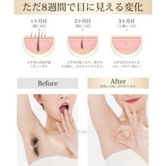 【未使用・検品のみ】 脱毛器 男女兼用 ヒゲ 男性 全身 99万発 冷却 軽量 vio対応 ジェル不要 IPL 光脱毛の画像