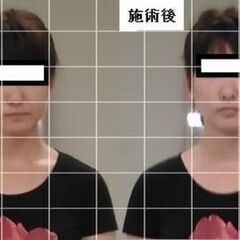 本日６月４日から１０日まで、歯と口の健康週間です！マスクでできた...