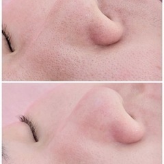 フェイシャルエステ通い放題✨ - 美容