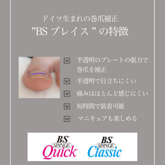 巻き爪ケア　モニター募集
