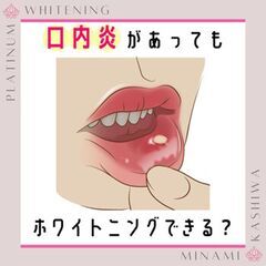 口内炎があってもホワイトニングできる？★口コミ好評！南柏でおすすめのホワイトニングサロン☆プラチナムホワイトニング南柏店の画像