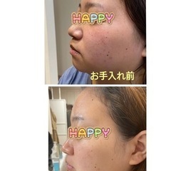 ⭐️1ヶ月美肌チャレンジ 