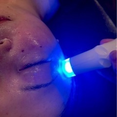 小顔矯正モニター90分