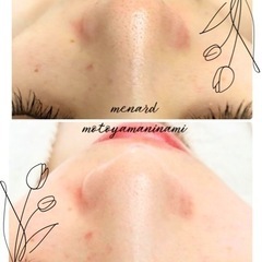 エステティシャン募集（未経験、未資格、未成年ok、学歴問わず）の画像