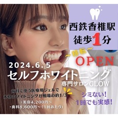 【ホワイトニングモニター募集】歯のホワイトニング