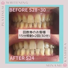プラチナムホワイトニング南柏店《口コミ好評！》駅近☆南柏にセルフ...