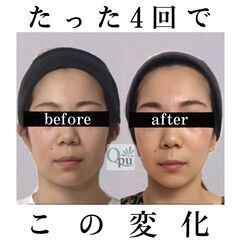 小顔矯正サロンオーナー募集！米子店（仮名）新規オープン【小顔矯正サロンQpu】の画像