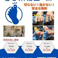 巻き爪のお悩み解決!痛くない巻き爪補正