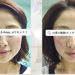 表情筋エステ短期セミナー募集中の画像