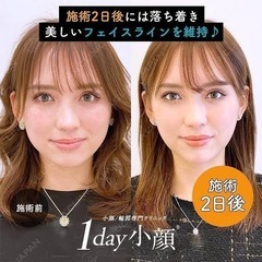 脂肪吸引イトリフトのモニター友達