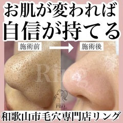 和歌山毛穴専門店
