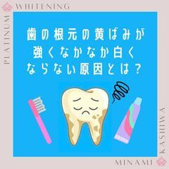 歯の根元の黄ばみが強い原因！【8/31まで！】★回数券が45%O...