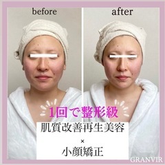 【福岡市 たるみしわ専門小顔整顔矯正】 - 福岡市