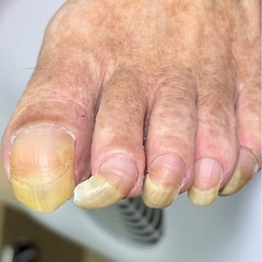 足爪綺麗にしましょう❗️お任せください❗️