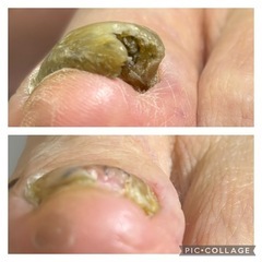 厚くなった爪も綺麗にしましょう❗️