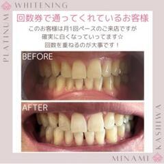 回数券で通っていただいているお客様のビフォーアフターです♪【口コ...