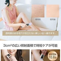 家庭用脱毛器の画像