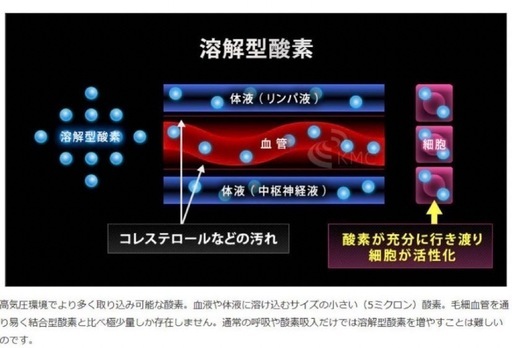 酸素カプセル