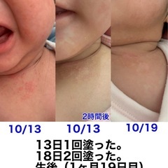 大人気🎵✨再生美容✨ 🌺体験キャンペーン🌺の画像