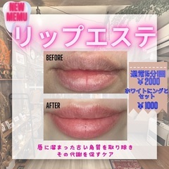 「新メニュー登場」リップエステ始めました💋