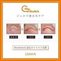 巻き爪モニター募集❗