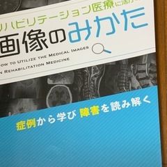 リハビリテーション医療に活かす　画像のみかた