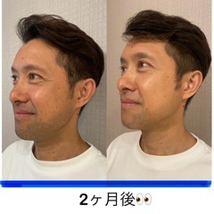 2025年は清潔感あるモテ肌を手に入れてみませんか？
