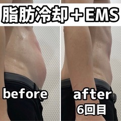 ✨無料体験　脂肪冷却＋筋肉増量✨ − 沖縄県