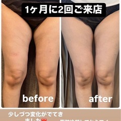 ✨無料体験　脂肪冷却＋筋肉増量✨ - 美容