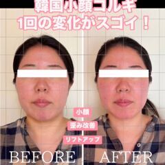 12月枠残りわずか🔥Yukui.式美顔縮小コルギ資格認定講座💜整...