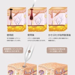 【新品】美容レーザーペン 美顔レーザースポットペン レーザー除去ペンの画像