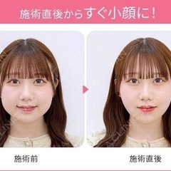 脂肪吸引、系リフトする友達