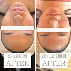 ２月受講生募集【沖縄▷大阪】小顔コルギ技術者認定講座❤️‍🔥即効...