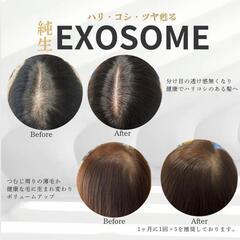 薄毛でお悩みの方必見👀✨