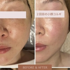 【小顔】韓国🇰🇷コルギで若々しいお顔を手に入れる