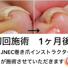 【⠀ジェルネイルフィルイン ＆ 巻き爪対応 レッスン】の画像