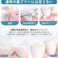 新品　ジェットウォッシャー  口腔洗浄機 ウォーターフロス  歯 口内洗浄  歯間ケア DIYモード 強度自由調整 300mLタンク コードレス 替えノズル IPX7防水 USB充電式の画像