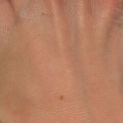 アンチエイジング　製剤　10mlの画像